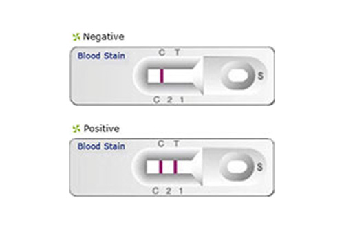 법과학 유전자 검사(혈흔) 검사 키트